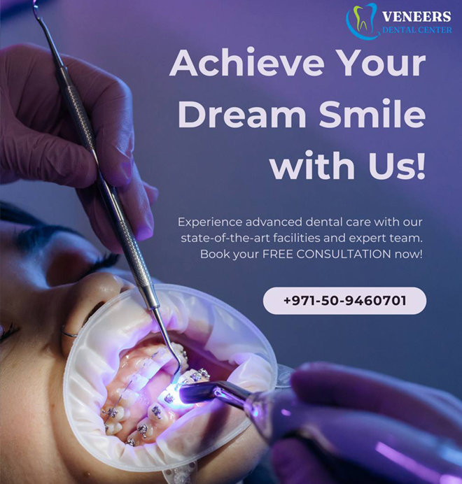 Veneers Dental Center clinic environment and cosmetic dental consultation in Dubai