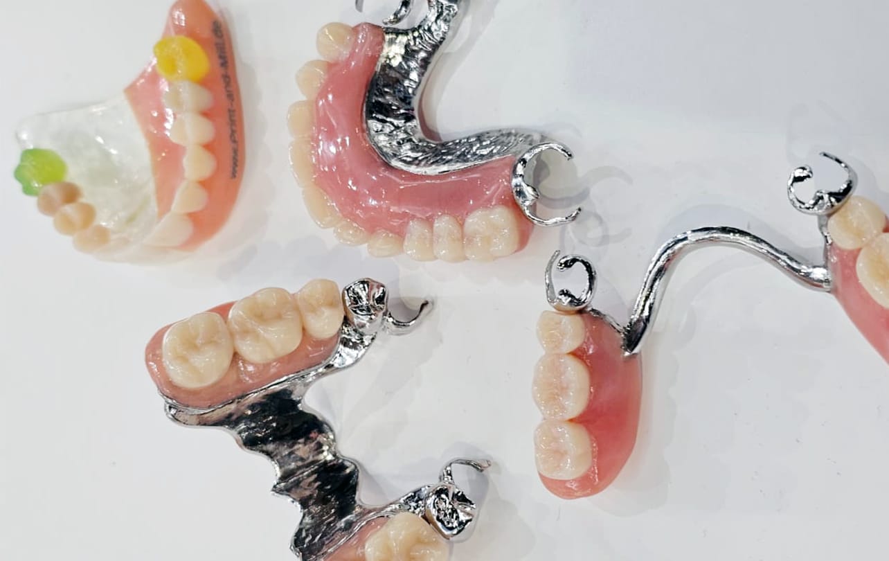 Durable zirconia crowns and dental bridges restoring damaged teeth